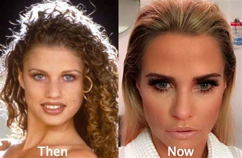 katie price teeth before and after|Katie Price Teeth: What’s Behind That Million